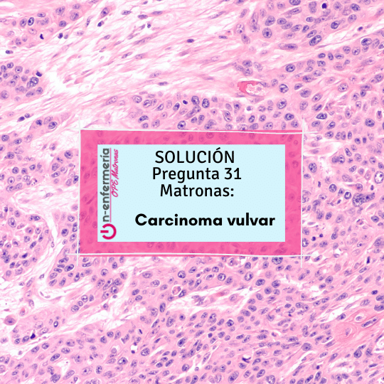 Pregunta OPE Matronas 31: Carcinoma in situ vulvar