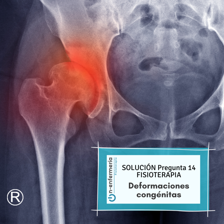 Solución pregunta examen OPE Fisioterapia 14 Deformaciones congénitas