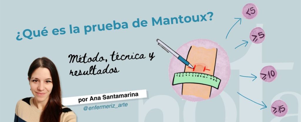 prueba de Mantoux técnica y resultados