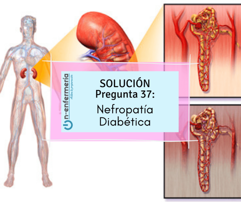 Oposición de Enfermería pregunta 37: Nefropatía Diabética