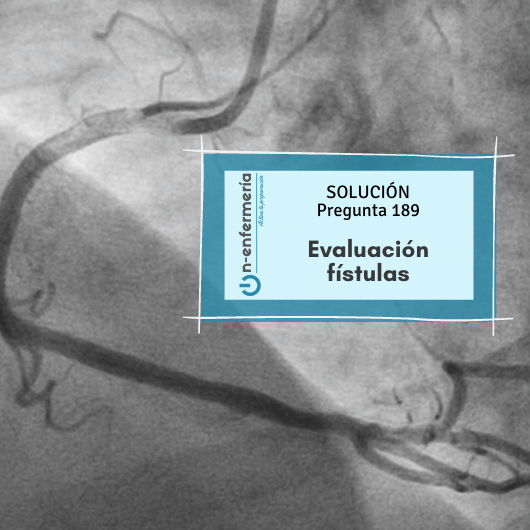 Pregunta examen OPE Enfermería nº 189: Fístulas arteriovenosas – Sistema cardiovascular