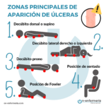 Infografía zonas de úlceras - Temario integridad cutánea OPE Enfermería