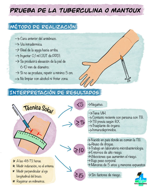 prueba de Mantoux - tuberculina